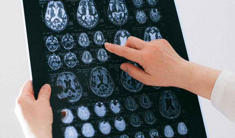 Magyar kutatók fejlesztése segíthet az epilepszia kezelésében